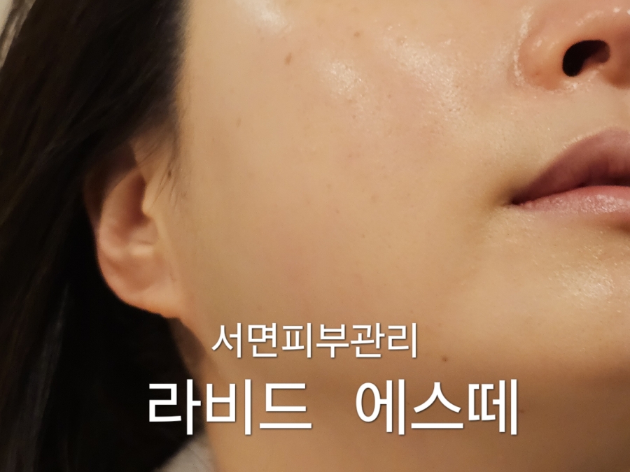 라비드에스테틱 이미지