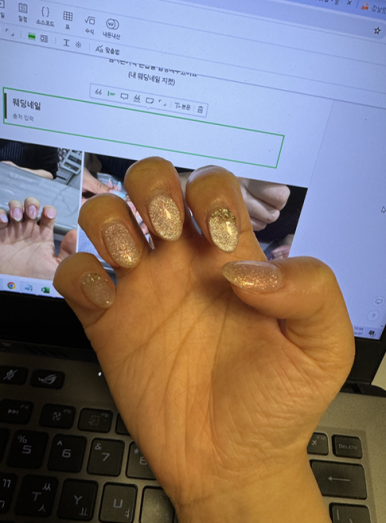 팡이네일 이미지