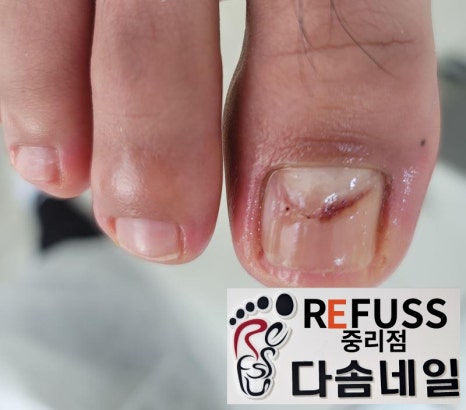 대전레푸스다솜네일 이미지