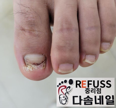대전레푸스다솜네일 이미지