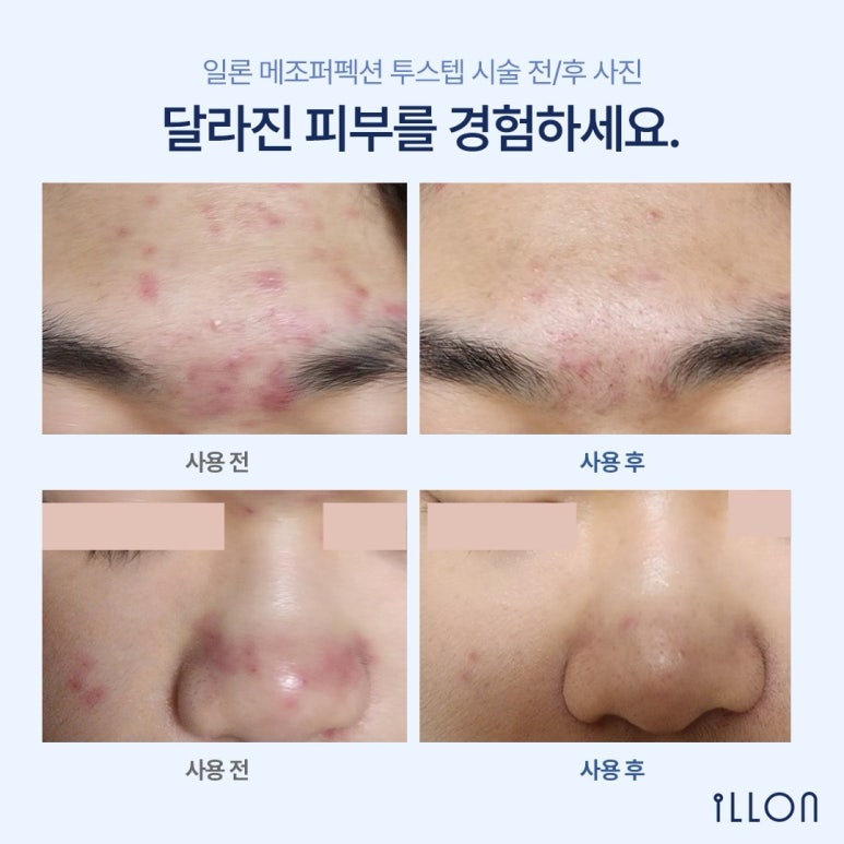 피부가꿈 이미지