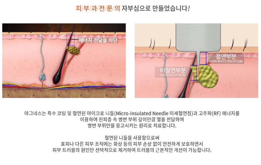 청담피부과 이미지