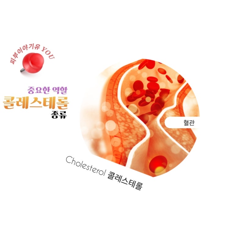 에이치디엘 이미지