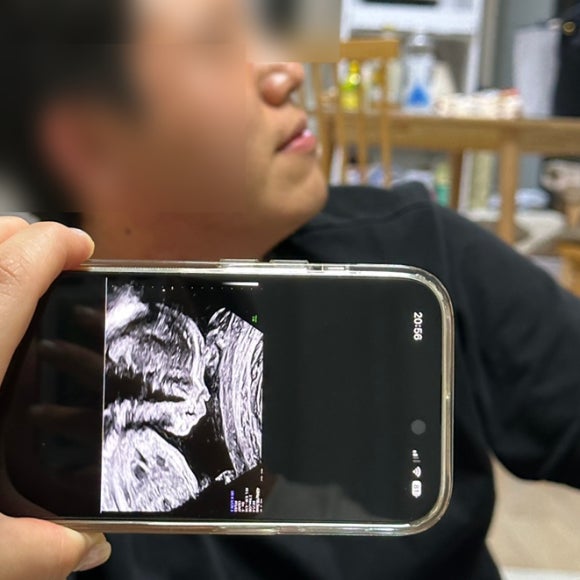 피지컬찜닭 이미지