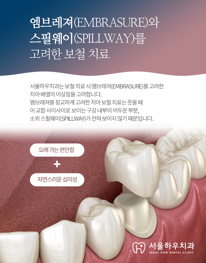 서울하우치과 이미지