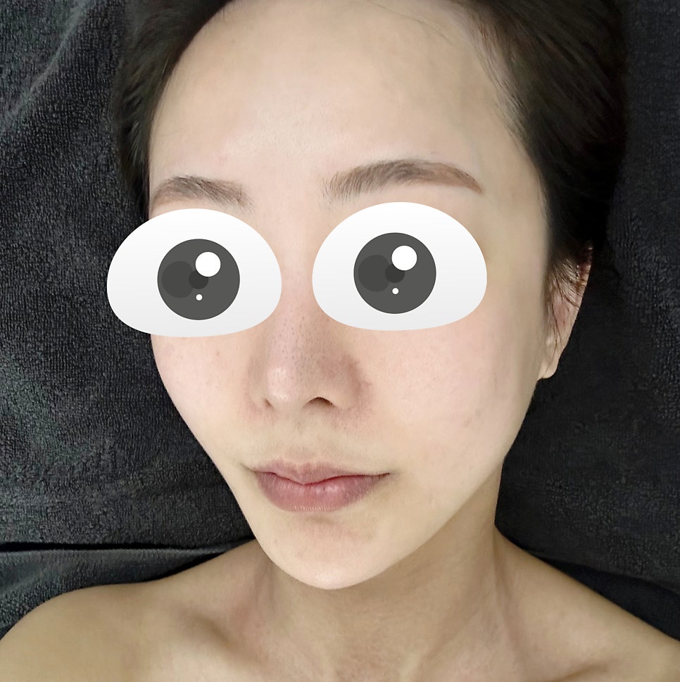 온본에스테틱 평택점 이미지