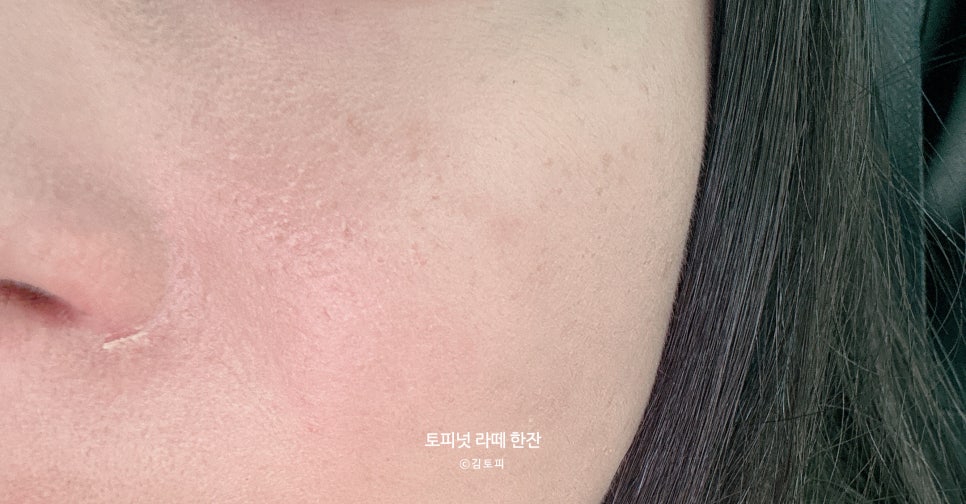 그린필스킨케어 이미지