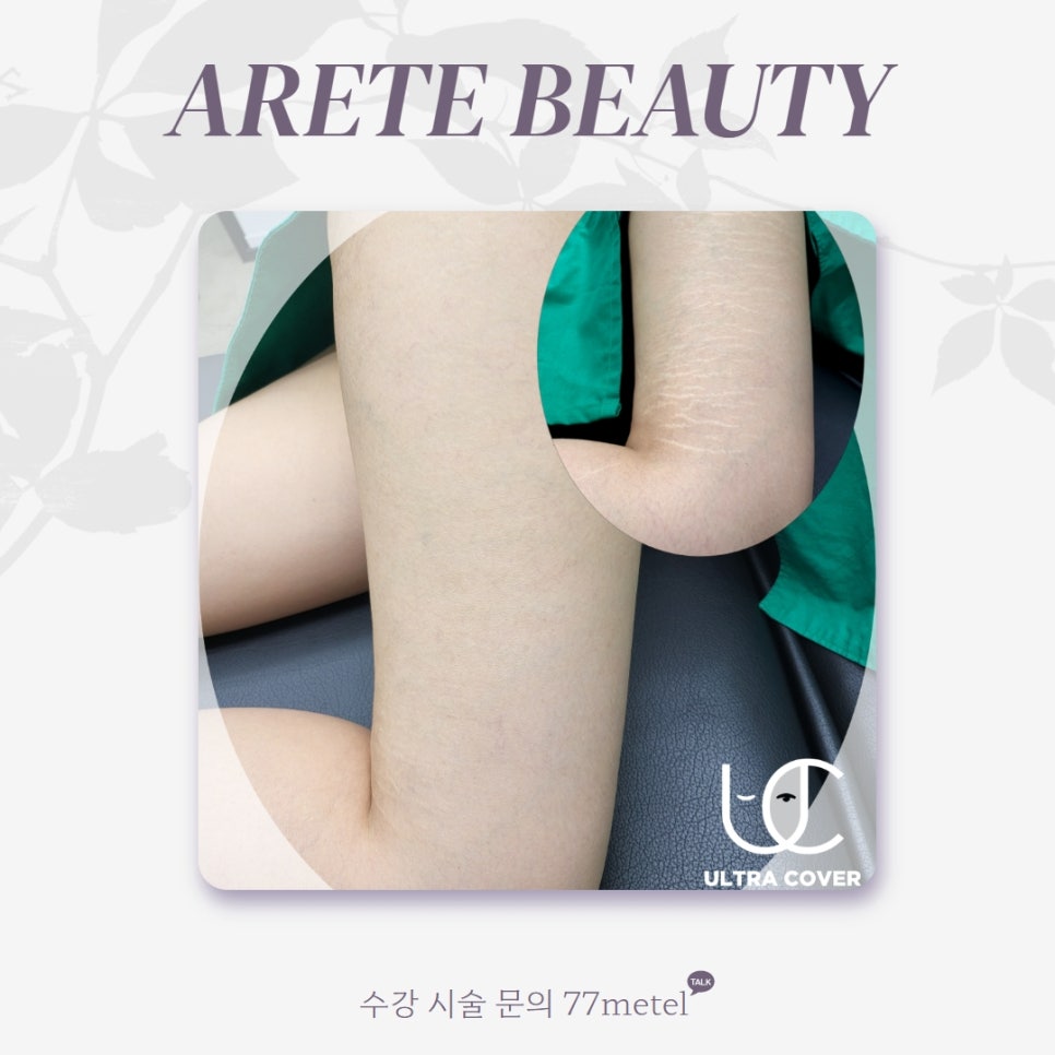 52아레테 이미지