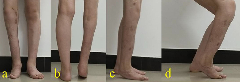 한국의지보조기학회 이미지