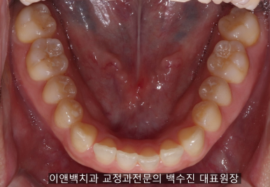 공감백치과 이미지