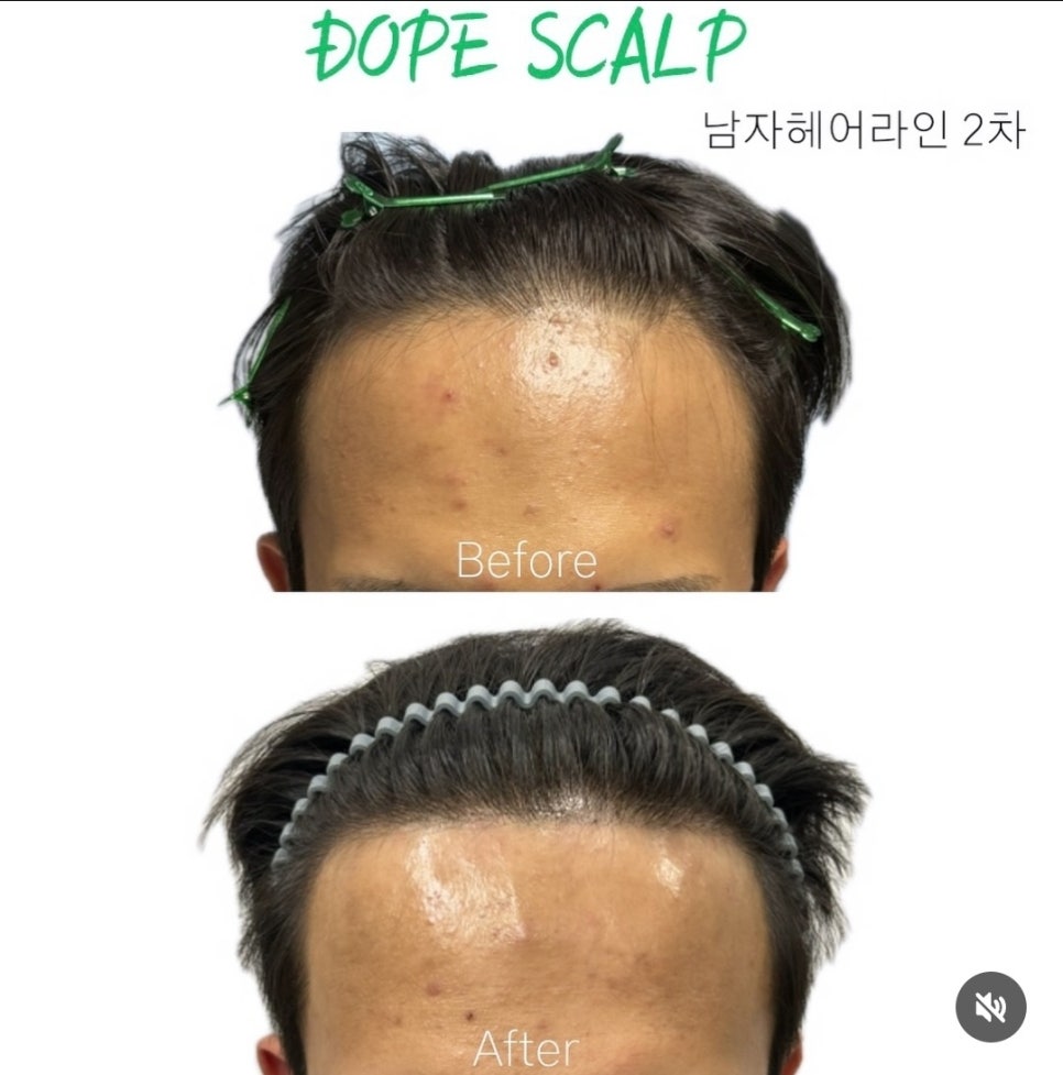 돕스칼프 이미지