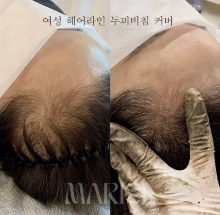 마리엘헤어 이미지
