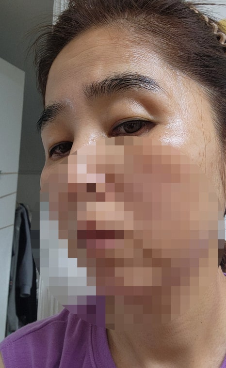 포픽스 이미지