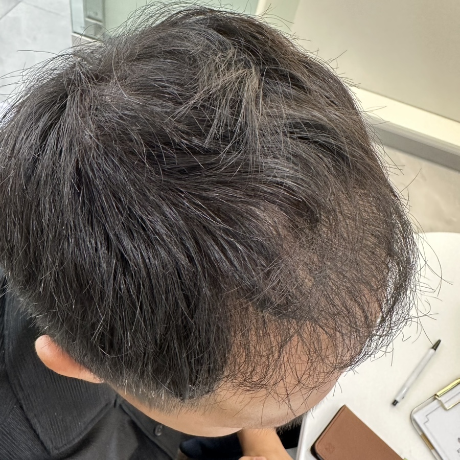 에코레비헤어헤드스파광주 이미지