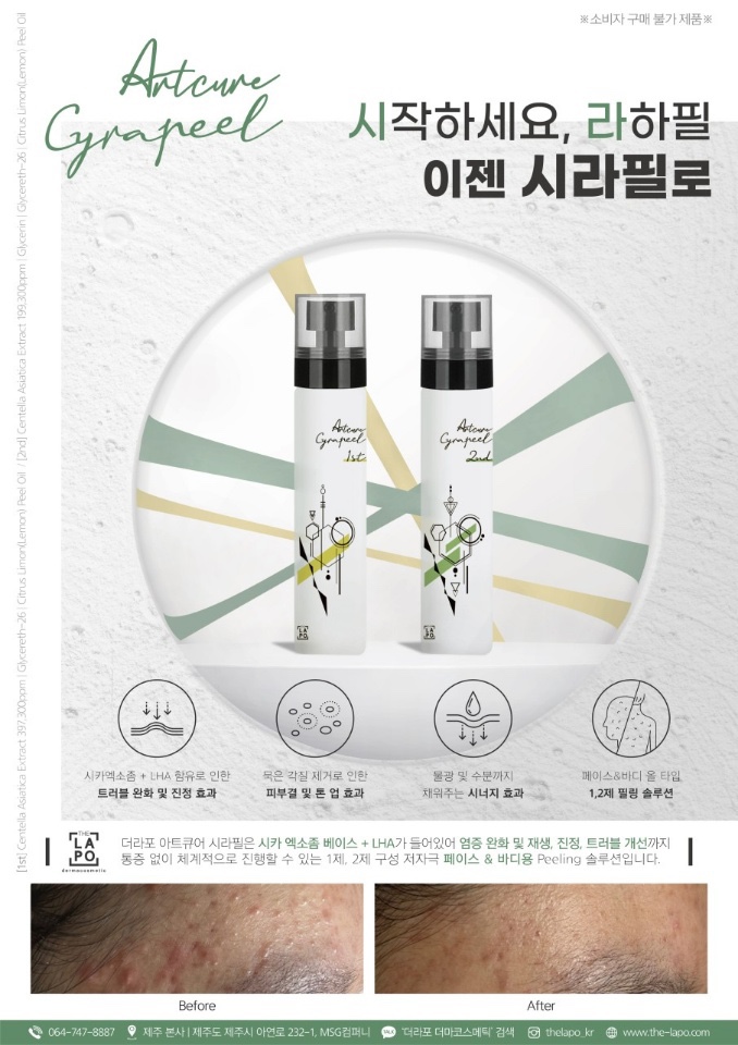 엔쏘에스테틱 이미지