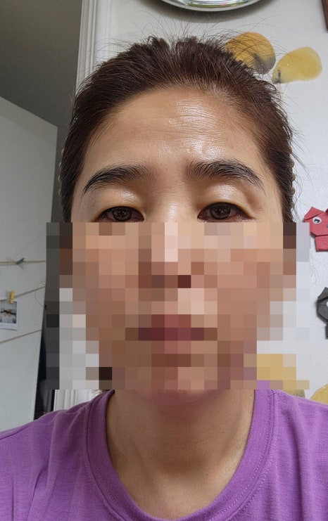 포픽스 이미지