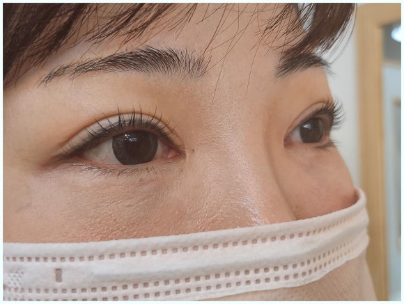 늘네일 이미지