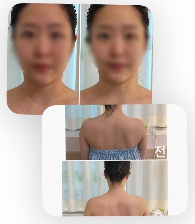 빛나스킨케어 이미지