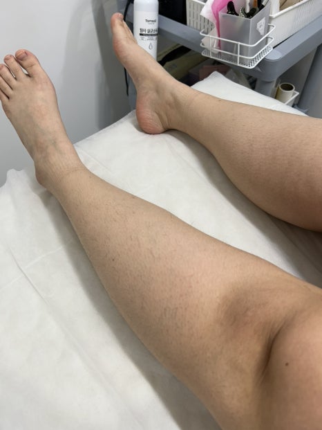 비니드헤어 이미지