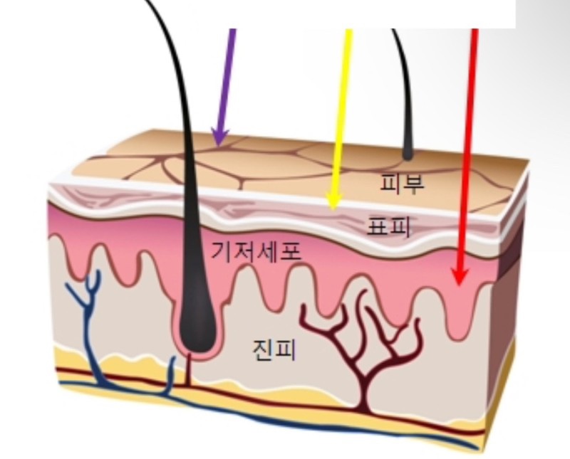 올인원홈케어 이미지