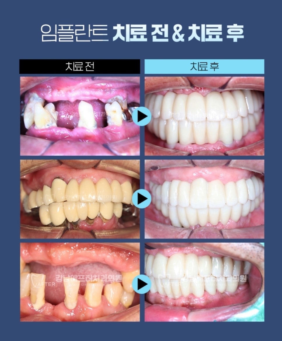 강남애프터치과 이미지
