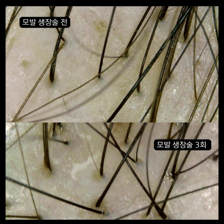 에츠하임 이미지