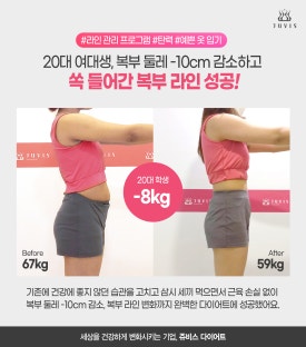 로빼 이미지