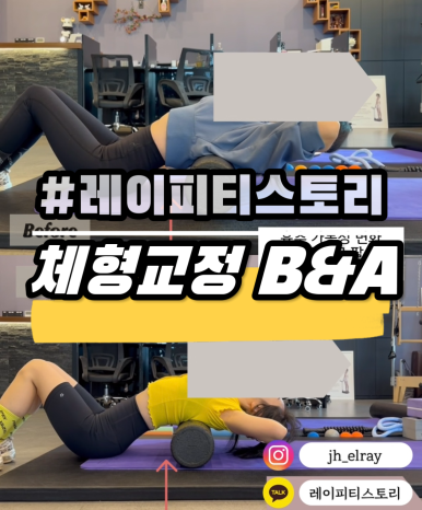 피티스토리 이미지