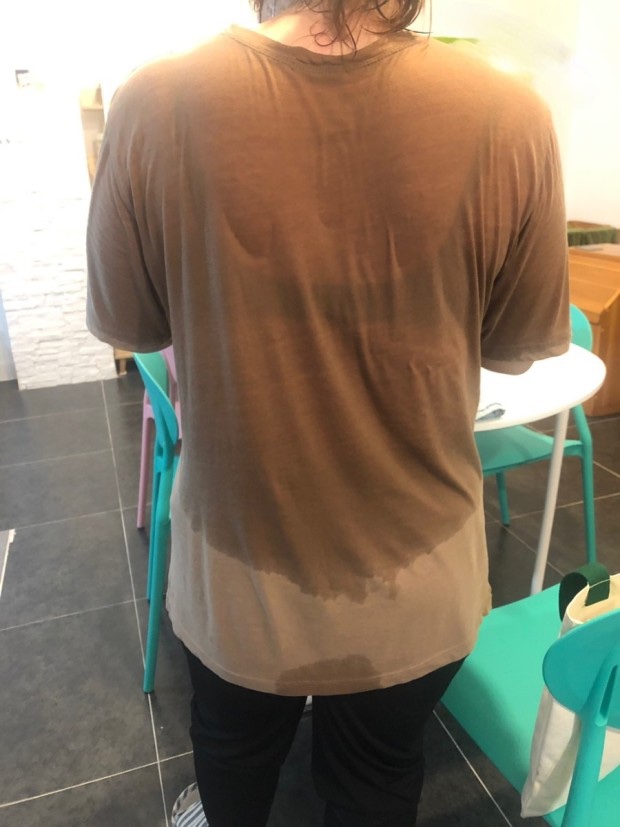 비비테라피 이미지