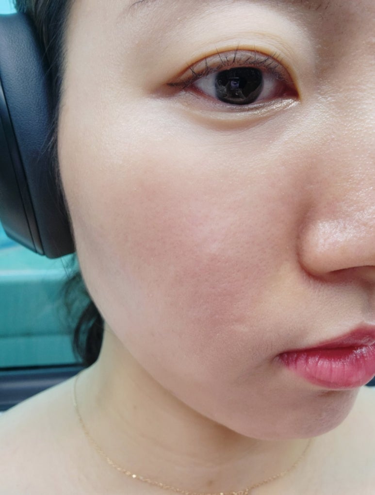 웰레스테틱 수원점 이미지