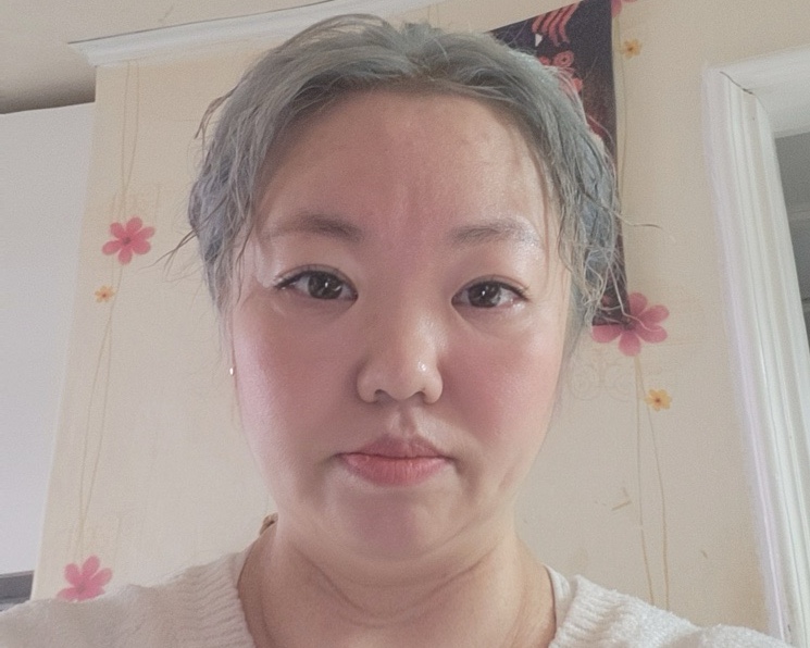피부아지트(뉴페이스) 이미지