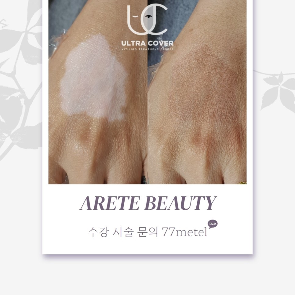 52아레테 이미지
