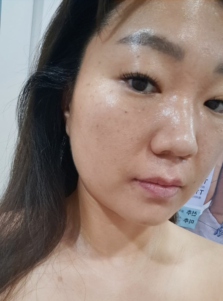 루시아 피부관리 이미지