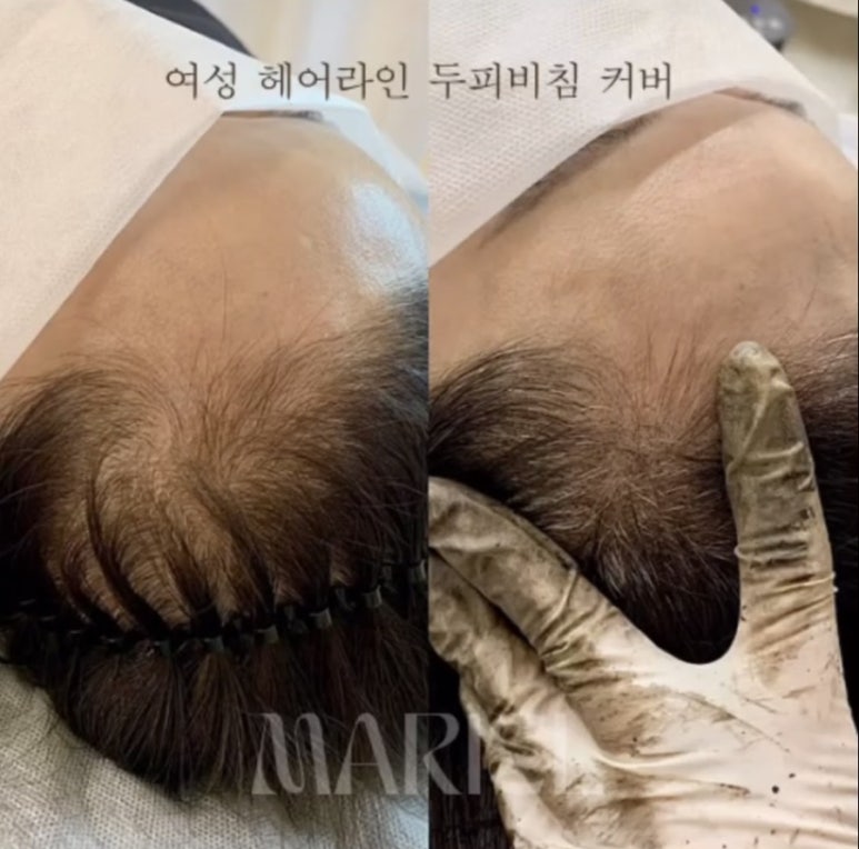 마리엘헤어 이미지