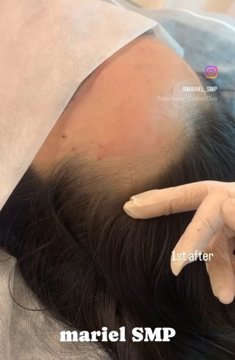 마리엘헤어 이미지