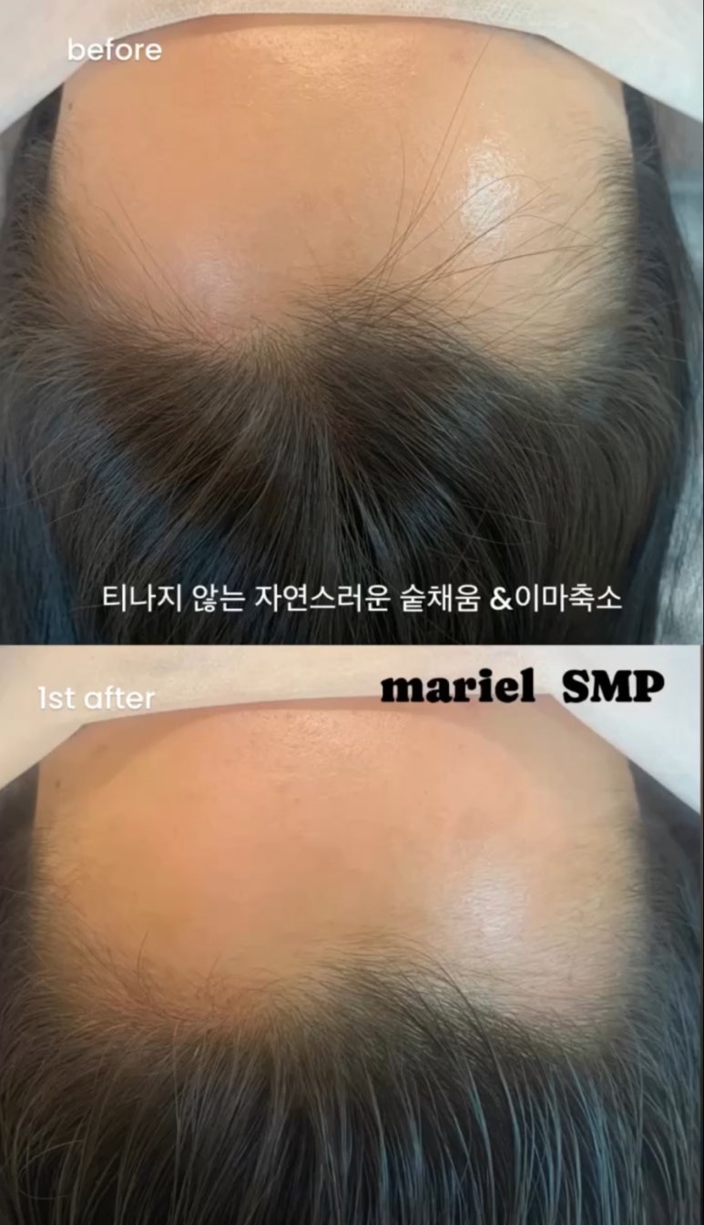 마리엘헤어 이미지