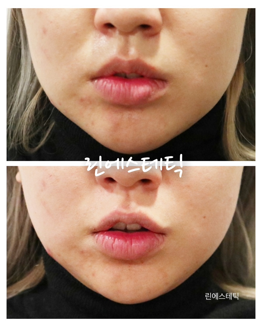 당산현대서비스 이미지