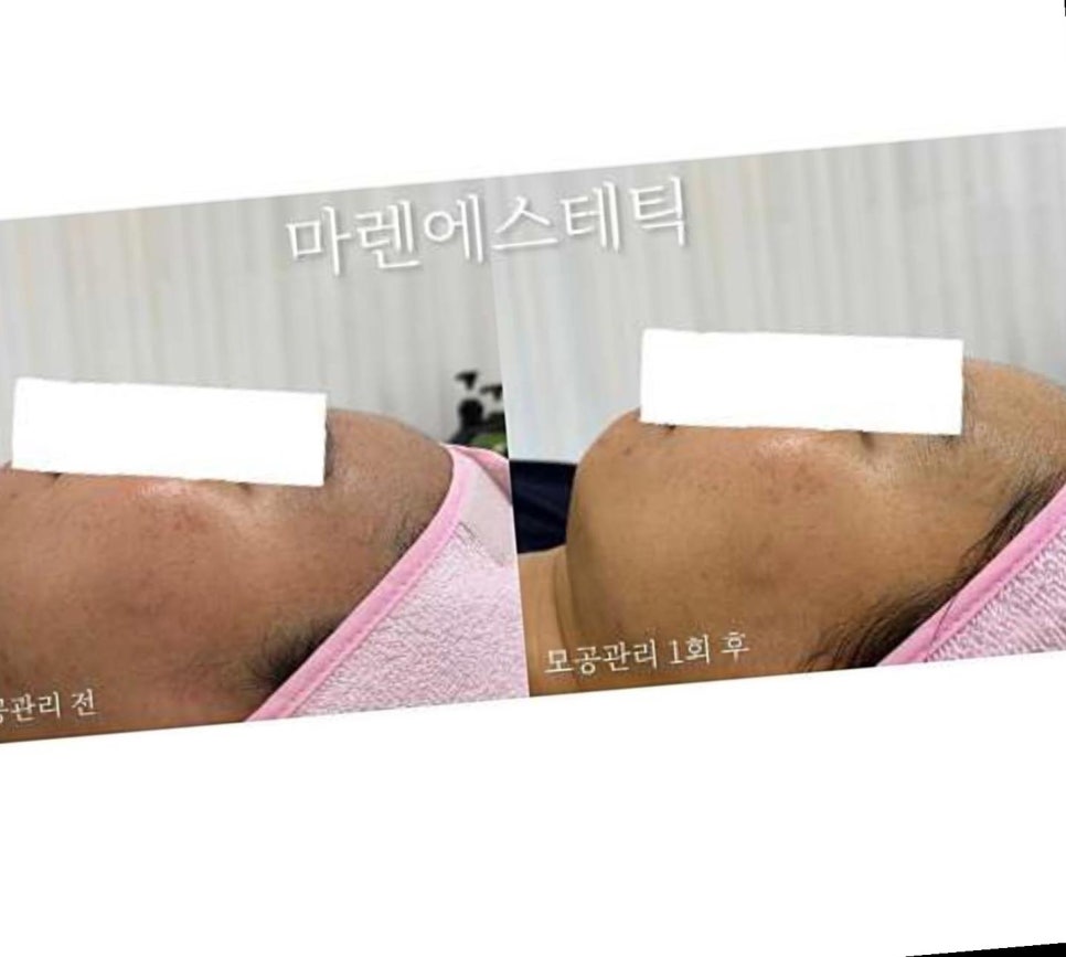 마렌에스테틱 이미지