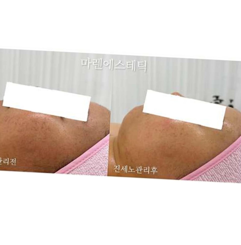 마렌에스테틱 이미지