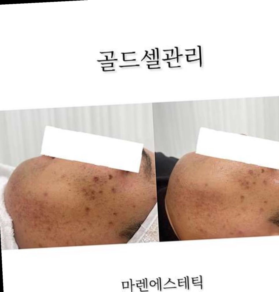 마렌에스테틱 이미지
