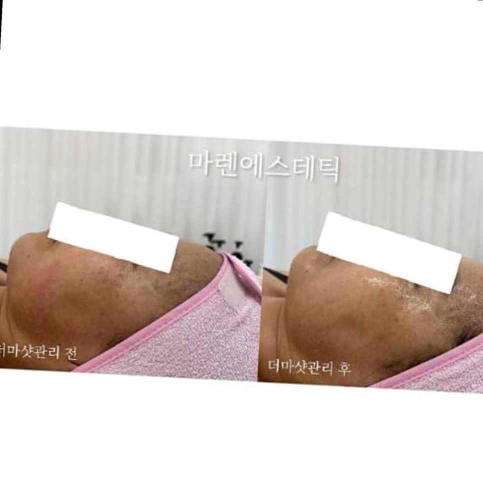 마렌에스테틱 이미지