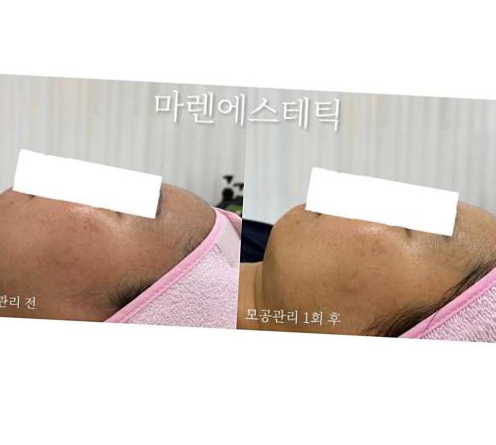 마렌에스테틱 이미지