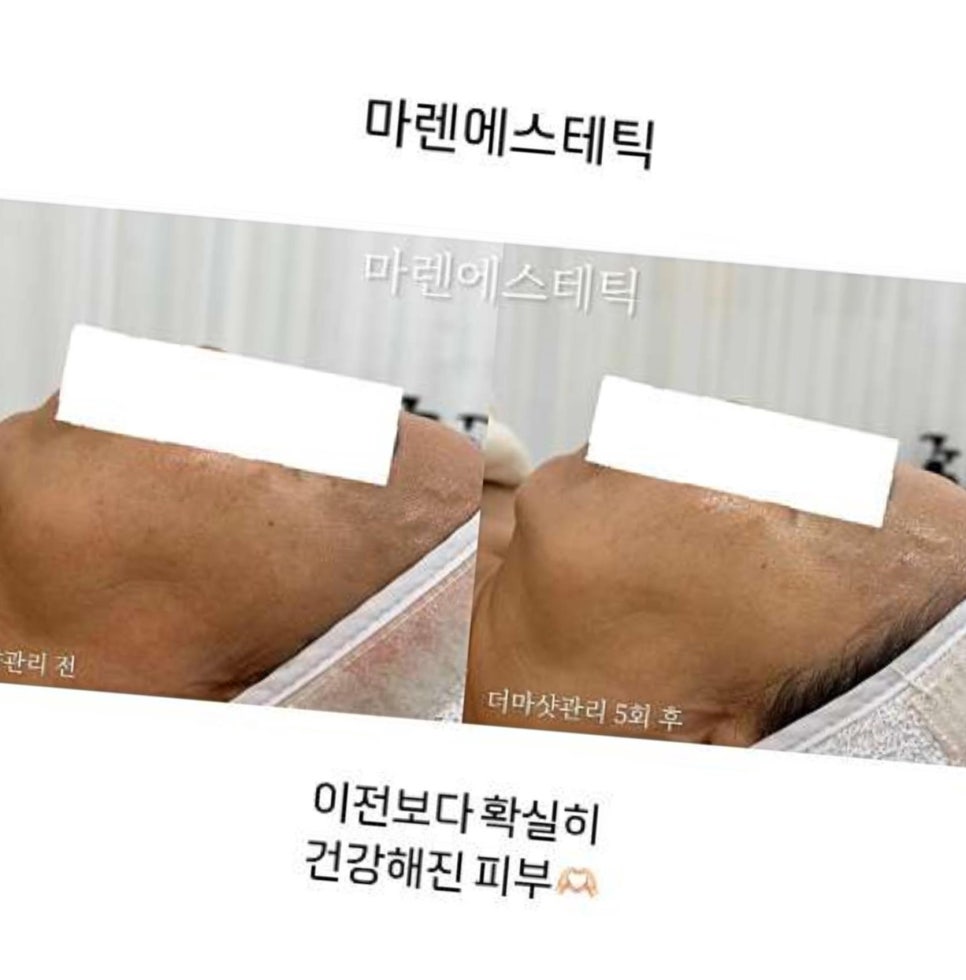 마렌에스테틱 이미지