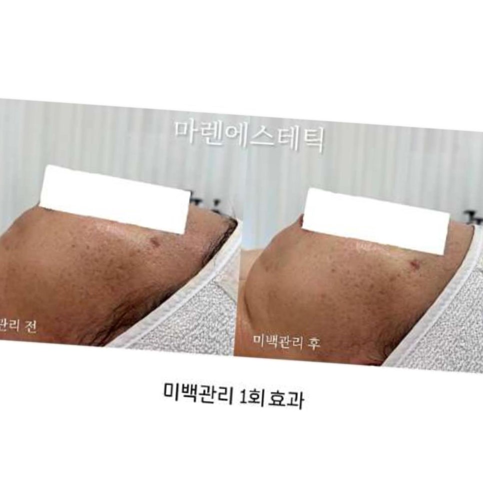 마렌에스테틱 이미지