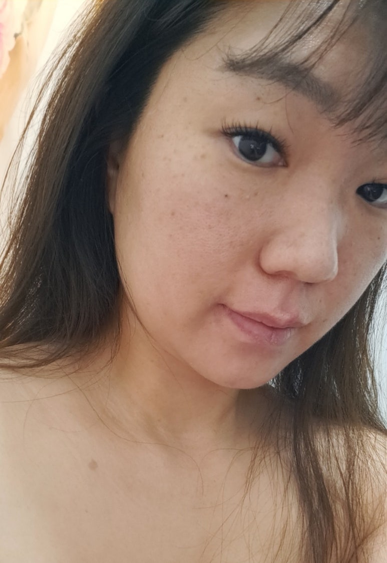 루시아 피부관리 이미지