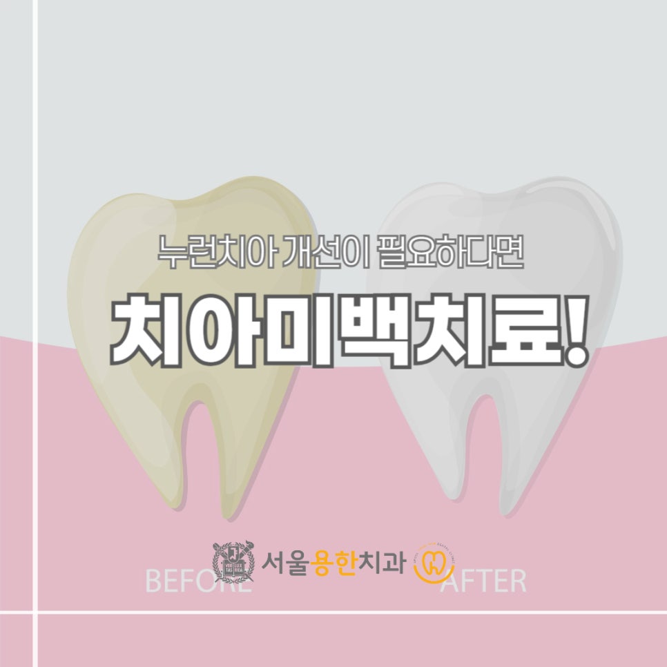 누런상회 이미지