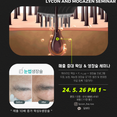 모셀러 이미지