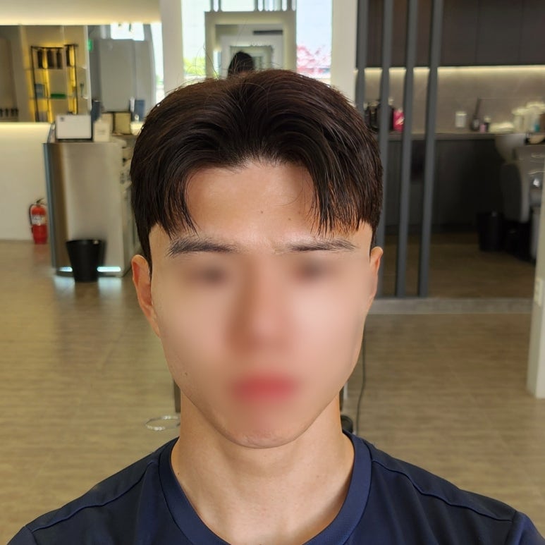 히스커 내포점 이미지