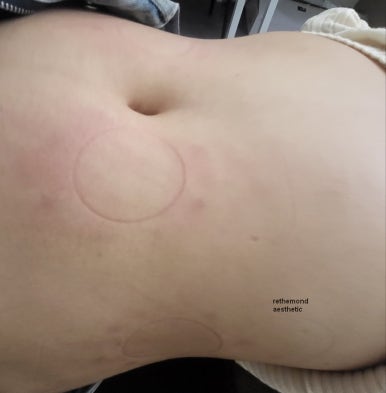 리더몬드 에스테틱 부산동래본점 이미지