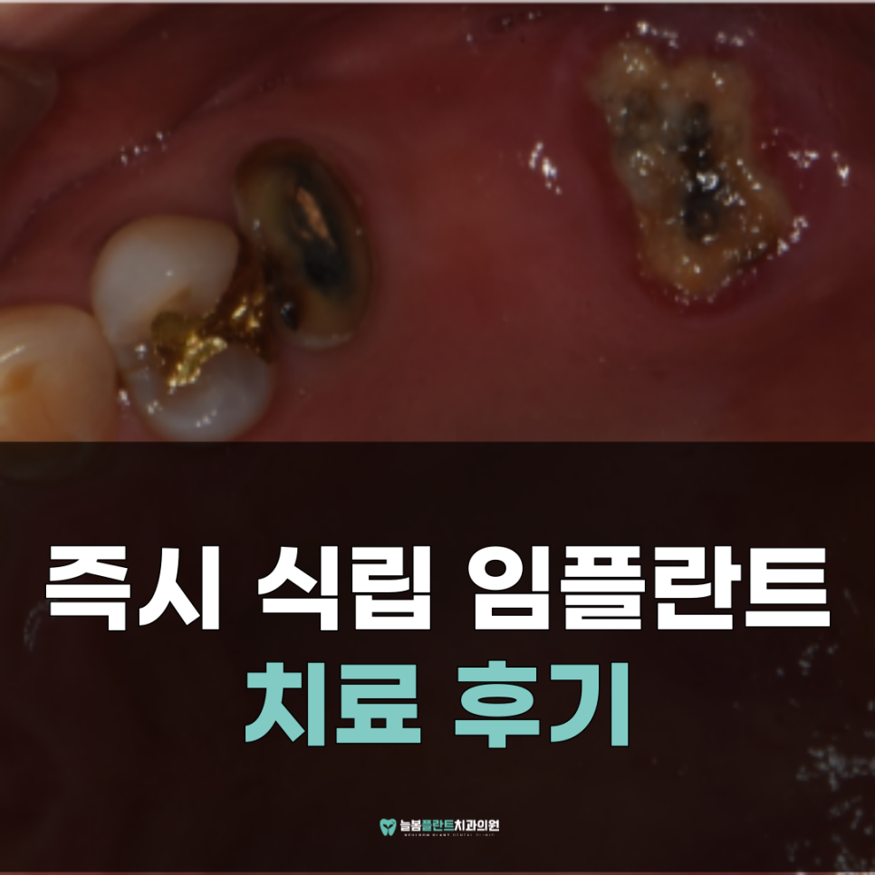 늘봄플란트치과 이미지